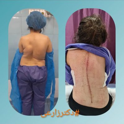 Dr. Mohammad Zarei - spine surgery specialist in Iran