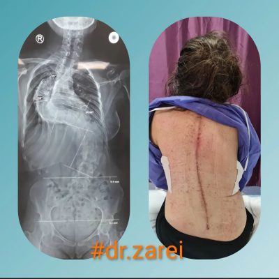 Dr. Mohammad Zarei - spine surgery specialist in Iran
