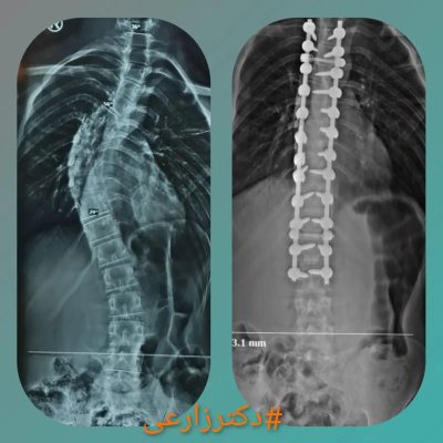 Dr. Mohammad Zarei - spine surgery specialist in Iran