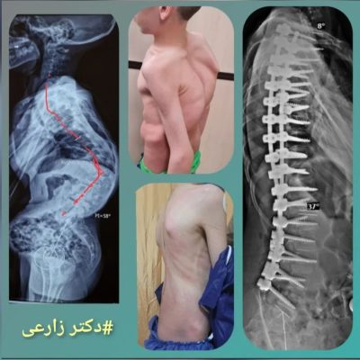 Dr. Mohammad Zarei - spine surgery specialist in Iran