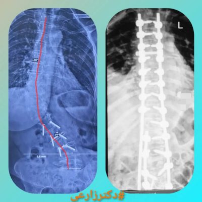 Dr. Mohammad Zarei - spine surgery specialist in Iran