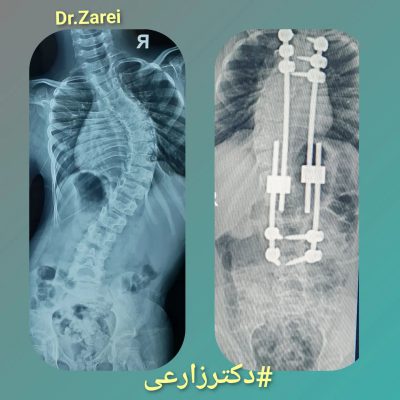 Dr. Mohammad Zarei - spine surgery specialist in Iran