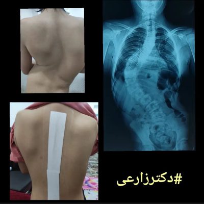 Dr. Mohammad Zarei - spine surgery specialist in Iran
