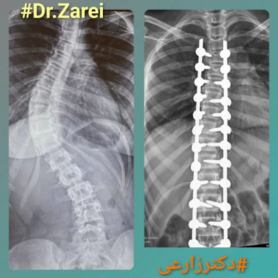 Dr. Mohammad Zarei - spine surgery specialist in Iran