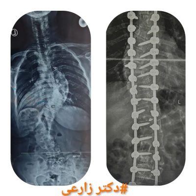 Dr. Mohammad Zarei - spine surgery specialist in Iran