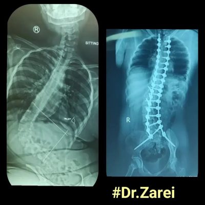 Dr. Mohammad Zarei - spine surgery specialist in Iran