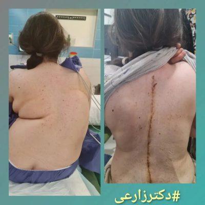 Dr. Mohammad Zarei - spine surgery specialist in Iran