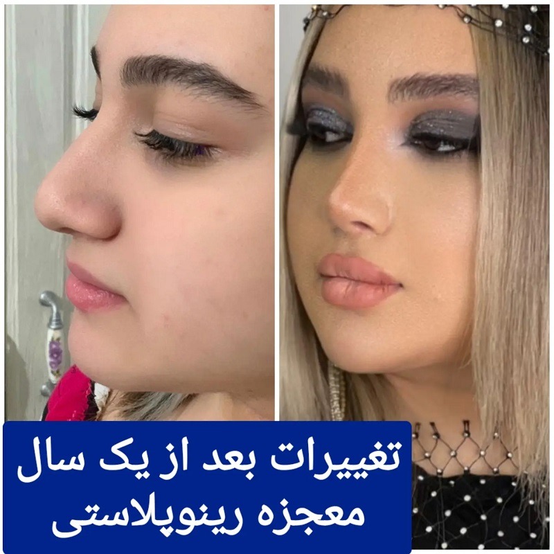 Dr. Hossein Rasool Panah Iran Medical Visa